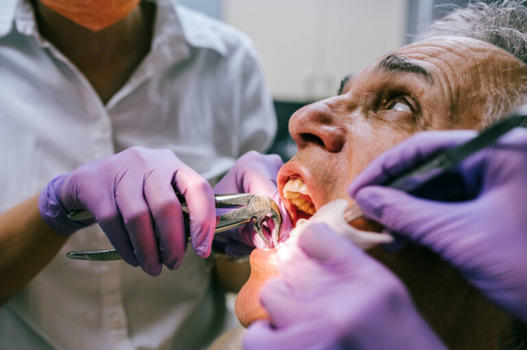 Tooth extraction